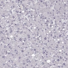 Immunohistochemical staining of human liver shows no positivity in hepatocytes as expected.