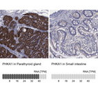 Anti-PHKA1 Antibody