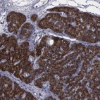 Immunohistochemical staining of human parathyroid gland shows high expression.