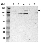 Lane 1: Marker [kDa] 219, 112, 85, 49, 32, 25, 18_br/_Lane 2: Human cell line RT-4_br/_Lane 3: Human cell line U-251MG sp_br/_Lane 4: Human cell line A-431_br/_Lane 5: Human liver tissue_br/_Lane 6: Human tonsil tissue