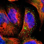 Immunofluorescent staining of human cell line A-431 shows localization to vesicles.