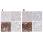 Immunohistochemical staining of human cerebral cortex, liver, lymphoid tissues and skeletal muscle using Anti-ARHGAP4 antibody HPA001083 (A) shows similar protein distribution across tissues to independent antibody HPA001012 (B).
