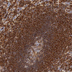 Anti-ARHGAP4 Antibody