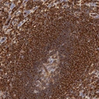 Immunohistochemical staining of human spleen shows strong cytoplasmic positivity in cells in red and white pulp.