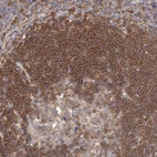 Immunohistochemical staining of human tonsil shows strong cytoplasmic positivity in germinal and non germinal center cells.
