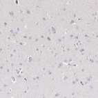 Immunohistochemical staining of human cerebral cortex shows very weak cytoplasmic positivity in neuronal cells.
