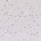 Anti-ARHGAP4 Antibody