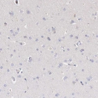 Immunohistochemical staining of human cerebral cortex shows very weak cytoplasmic positivity in neuronal cells.