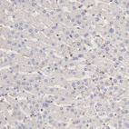 Anti-ARHGAP4 Antibody