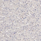 Immunohistochemical staining of human liver shows very weak cytoplasmic positivity in hepatocytes.
