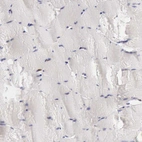 Immunohistochemical staining of human skeletal muscle shows very weak cytoplasmic positivity in myocytes.