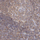 Immunohistochemical staining of human lymph node shows moderate cytoplasmic positivity in lymphocytes.