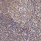 Immunohistochemical staining of human lymph node shows moderate cytoplasmic positivity in lymphocytes.