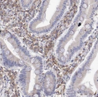 Immunohistochemical staining of human duodenum shows moderate cytoplasmic positivity in lymphoid cells.