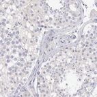 Immunohistochemical staining of human testis shows no positivity in cells in seminiferous ducts as expected.