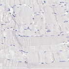 Immunohistochemical staining of human skeletal muscle shows no positivity in myocytes as expected.