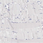 Immunohistochemical staining of human skeletal muscle shows no positivity in myocytes as expected.