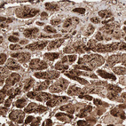 Anti-ACO2 Antibody