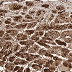 Immunohistochemical staining of human heart muscle shows strong granular cytoplasmic positivity in cardiomyocytes.