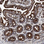 Immunohistochemical staining of human duodenum shows strong strong granular cytoplasmic positivity in glandular cells.