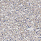 Anti-ACO2 Antibody