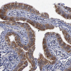 Immunohistochemical staining of human fallopian tube shows strong cytoplasmic positivity in glandular cells.