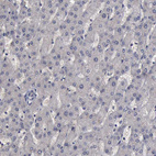 Immunohistochemical staining of human liver shows no positivity in hepatocytes as expected.