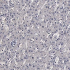 Immunohistochemical staining of human liver shows no positivity in hepatocytes as expected.