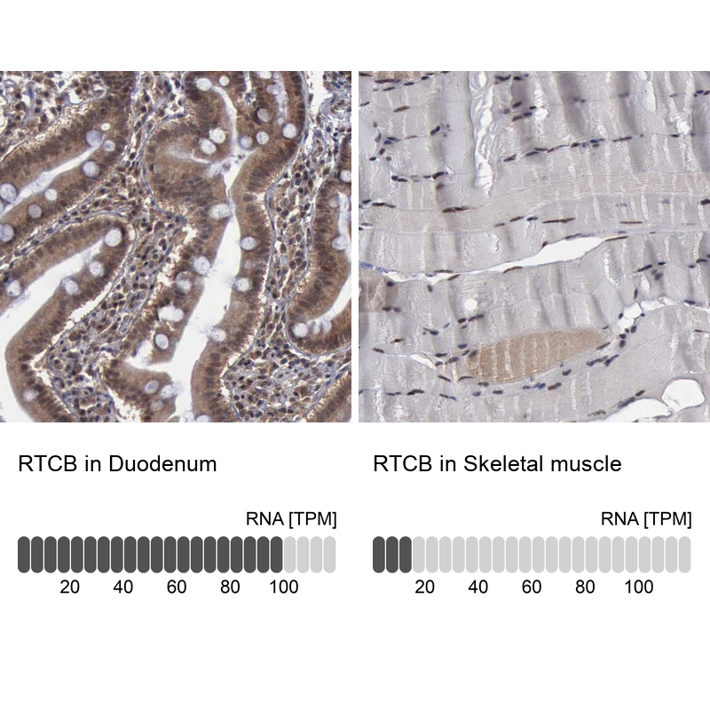 Anti-RTCB Antibody
