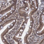 Immunohistochemical staining of human duodenum shows high expression.
