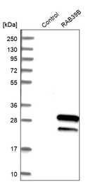 Western blot analysis in control (vector only transfected HEK293T lysate) and RAB39B over-expression lysate (Co-expressed with a C-terminal myc-DDK tag (~3.1 kDa) in mammalian HEK293T cells, LY406800).