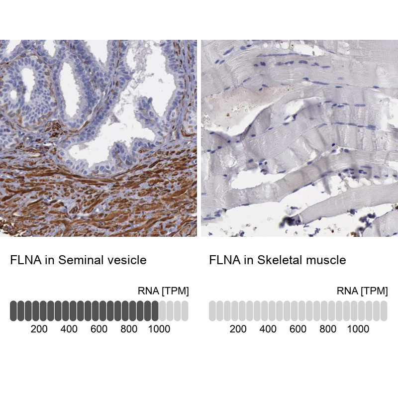 Anti-FLNA Antibody