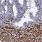 Immunohistochemical staining of human seminal vesicle shows high expression.