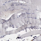 Immunohistochemical staining of human skeletal muscle shows low expression as expected.