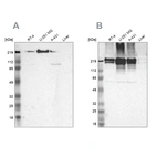 Western blot analysis using Anti-FLNA antibody HPA001115 (A) shows similar pattern to independent antibody HPA002925 (B).