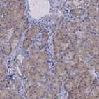 Anti-CEP128 Antibody