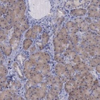 Anti-CEP128 Antibody