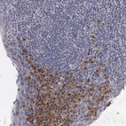 Anti-CEP128 Antibody
