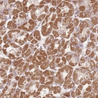 Anti-DTD2 Antibody