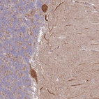 Immunohistochemical staining of human cerebellum shows moderate cytoplasmic positivity in Purkinje cells.