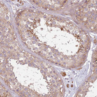 Immunohistochemical staining of human testis shows moderatemcytoplasmic positivity in cells in seminiferous ducts.