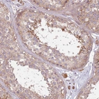 Immunohistochemical staining of human testis shows moderatemcytoplasmic positivity in cells in seminiferous ducts.