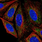 Immunofluorescent staining of human cell line SiHa shows localization to vesicles.