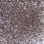 Anti-YY1 Antibody