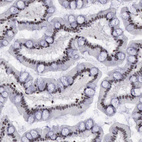 Immunohistochemical staining of human small intestine shows moderate nuclear positivity in glandular cells.