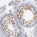 Anti-WDHD1 Antibody