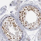 Immunohistochemical staining of human testis shows strong nuclear positivity in cells in seminiferous ducts.