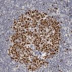 Immunohistochemical staining of human lymph node shows strong nuclear positivity in germinal center cells.