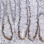 Anti-WDHD1 Antibody