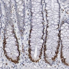 Immunohistochemical staining of human rectum shows strong nuclear positivity in glandular cells.